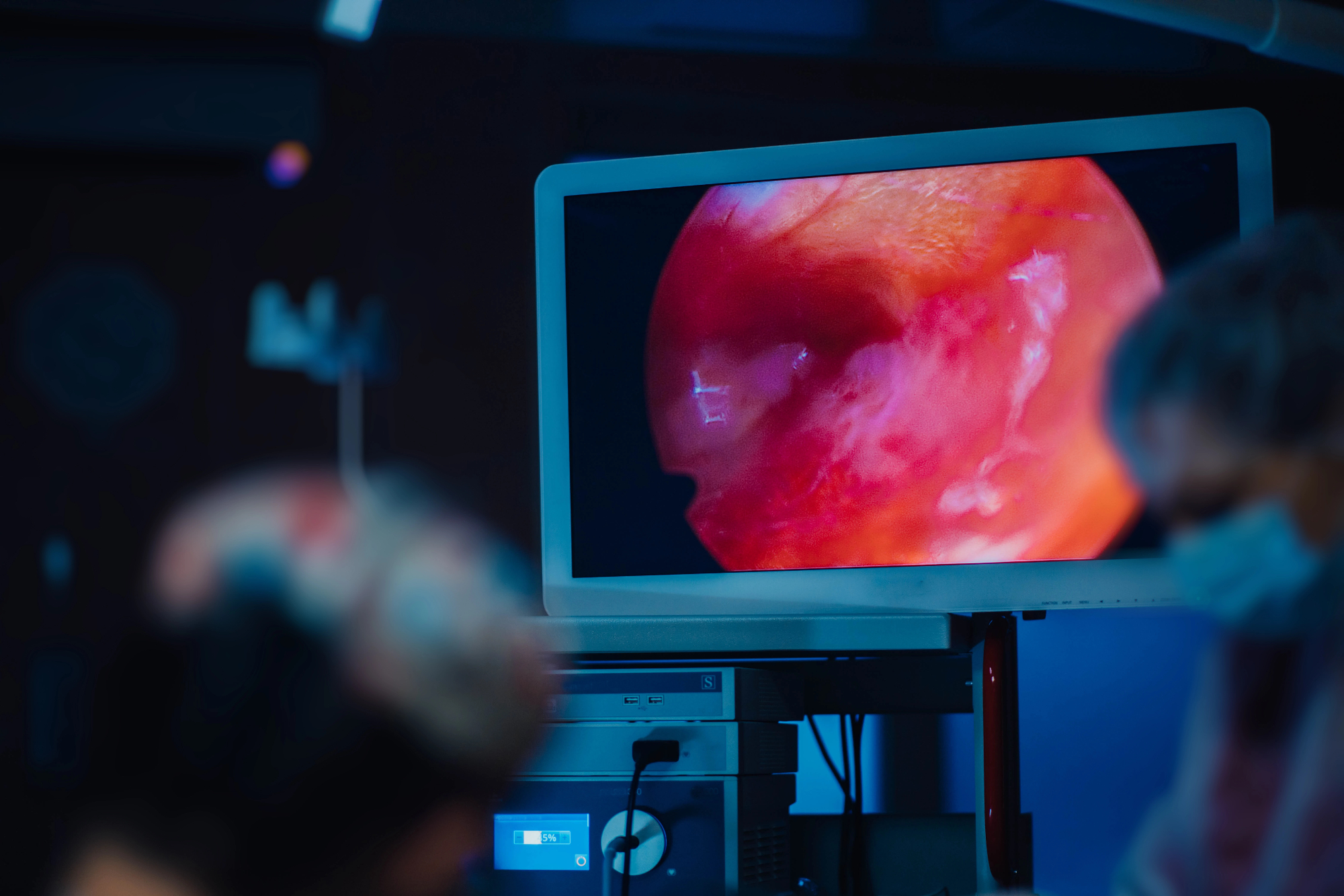 Gastroskopija - moja izkušnja je dobra.